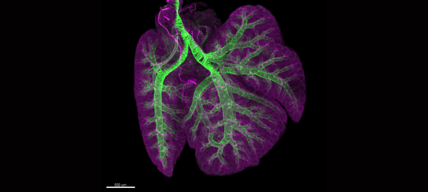 An image of a fetal lung labeled in 3 dimensions. Pink labels blood vessels and green labels muscle that wraps around the airways and vessels. These exemplify some experiments we will be performing in the proposed research.